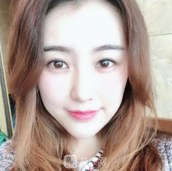 总体消化吸收的十分较为好，看上去看起来自身更年轻