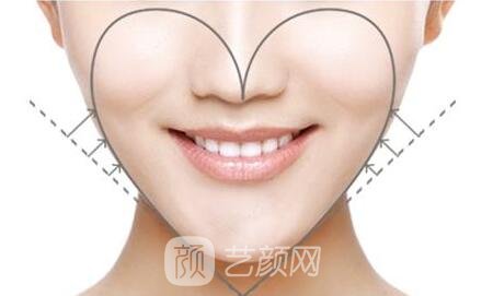 医生需要根据患者自身面部五官的比例，来确定患者所需要填充脂肪的多少
