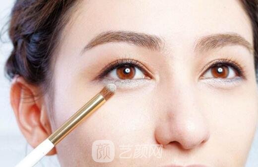 自体脂肪填充的方式也是有很多优点的