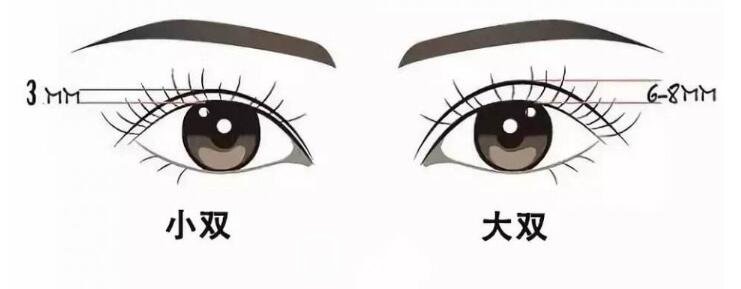 想做全切双眼皮，宽度多少比较自然？