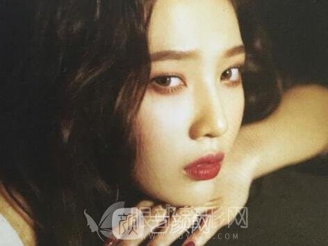 做完双眼皮拆线之后多久才能洗脸?