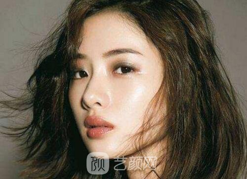 常说的微创双眼皮是不是就是韩式定点双眼皮呢？