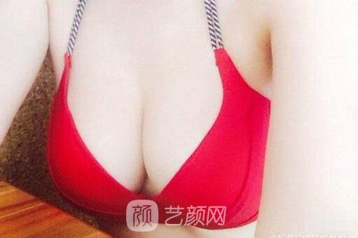 术后可能会产生乳房形变的情况,