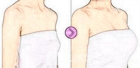 自体脂肪丰胸手术后的常见问题