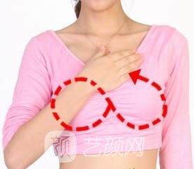 假体丰胸手术术后怎样护理?