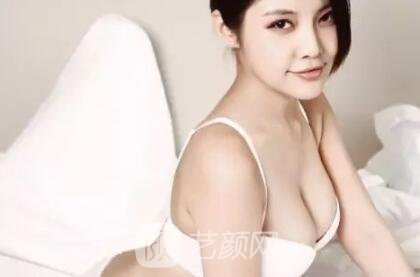 假体隆胸失败修复时间:到底术后多久才能做修复?