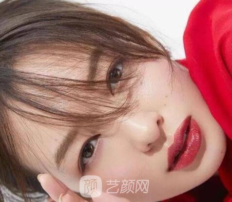 割双眼皮微创好还是全切好?戳进来康康哪种适合你!