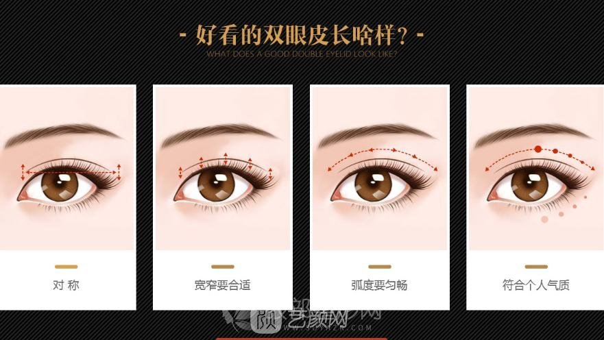 双眼皮埋线法适合哪些人