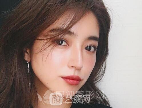 双眼皮埋线法好不好 你的眼型该如何选择术式