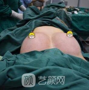 丰胸手术修复医院该如何挑选呢?