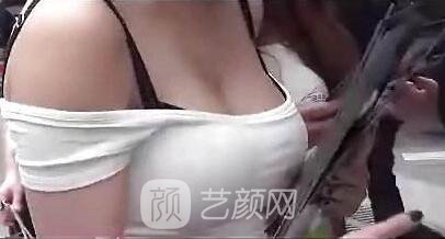 乳房的真相:隆胸的痛!