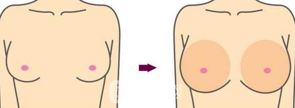 隆胸后,你会给你的胸部打多少分?