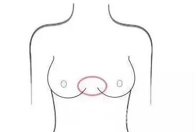 隆胸后,你会给你的胸部打多少分?