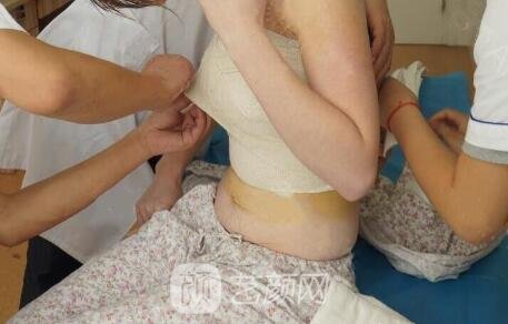 以下原因导致隆胸会被发现