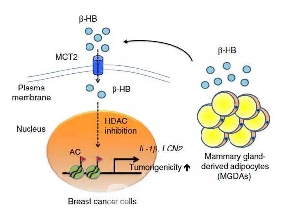 胸大的人更容易患乳腺癌？
