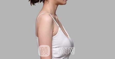 乳房下垂是谁的错?应该如何拯救下垂的乳房?