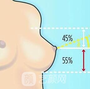 胸部下垂可分成哪几种呢?