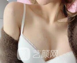 没问题丰胸的方法有哪些？