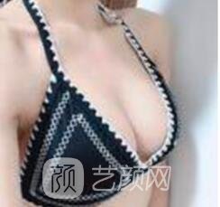 没问题丰胸的方法有哪些？