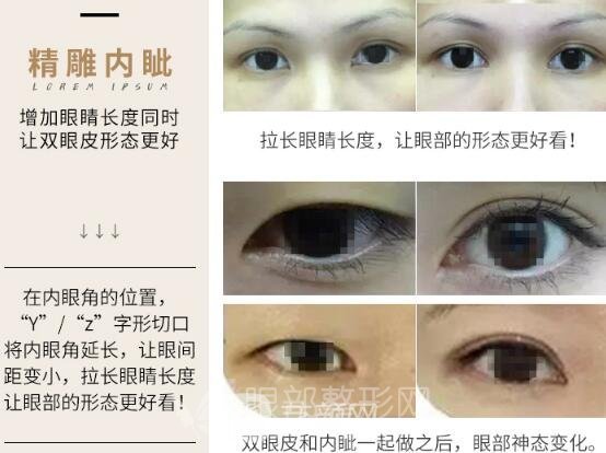开眼角手术果