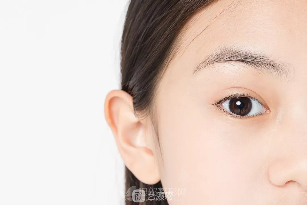 高分子双眼皮轻松让你变成女神，成为人群中较靓的那一个！