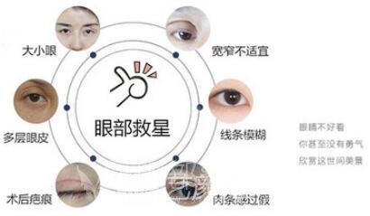 北京做双眼皮手术哪里比较好