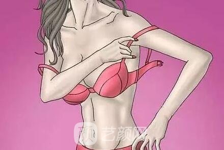 三种副乳必须手术调节!