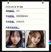 汪帅耳软骨鼻部手术案例分享，不容错过~