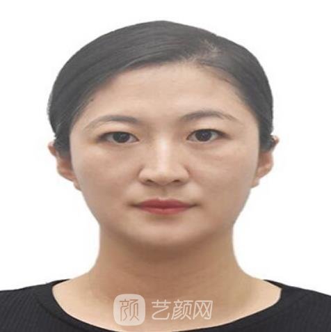 王晓菲