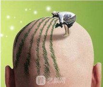 上海三甲医院植发价格表