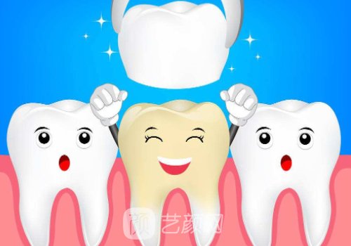 威兰德臻瓷全瓷牙多少钱