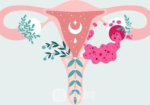 3d束带紧缩术的后遗症有什