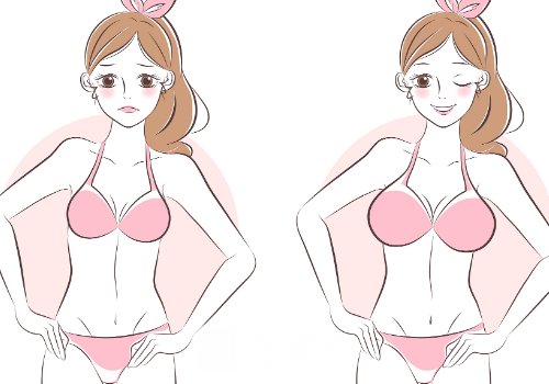 艾斯美假体一般寿命几年