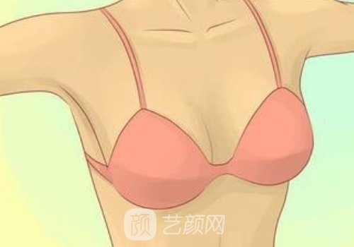 艾斯美假体和曼托水滴哪