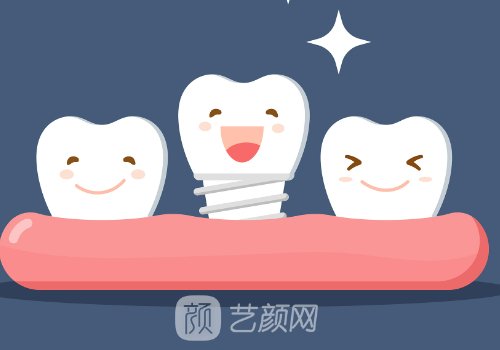 美国3i种植体型号有哪些