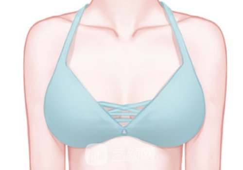 伊维兰5d童颜针可以丰胸吗