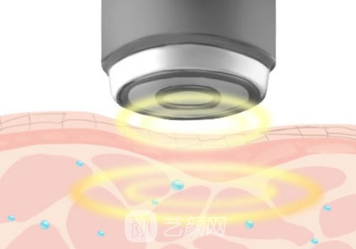 金达威聚拉美多久有效果