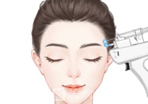 芙洛拉水光针多少钱一针