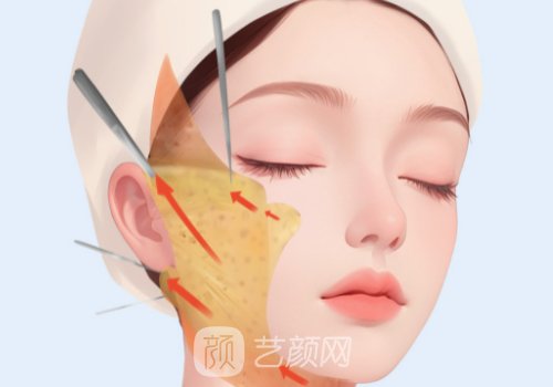 维维提升效果怎么样?原理