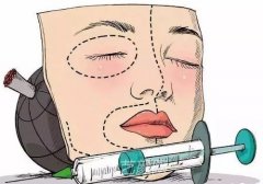 泊沃林玻尿酸多少钱?受到