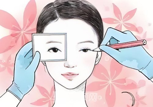 唐山做双眼皮手术价格是