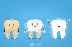 士卓曼种植牙体有国产的