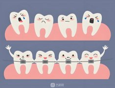 士卓曼种牙等级，分为三