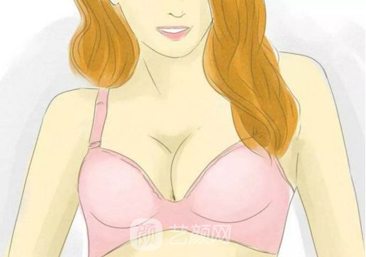 成都自体脂肪填胸价格贵