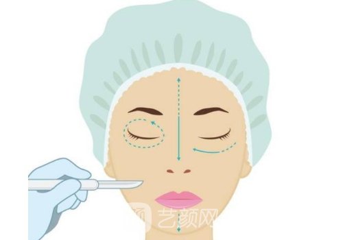 舒缇雅骨胶原是进口还是