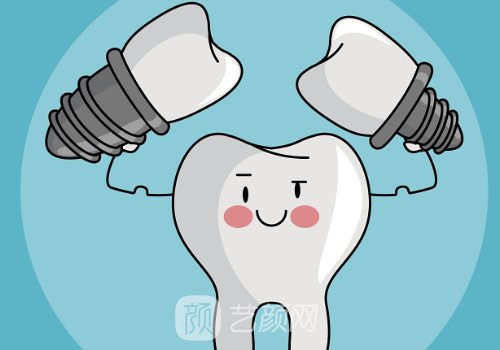 奥齿泰和登腾哪个质量更