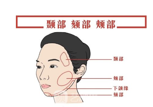 筋膜提升和线雕有什么不