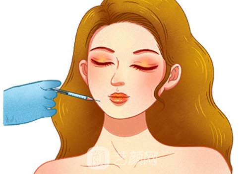 筋膜提升能维持多久多少