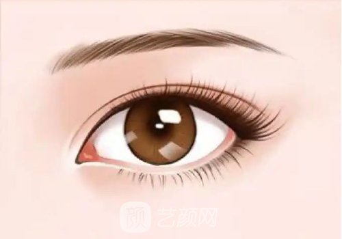 北京王太玲双眼皮修复多