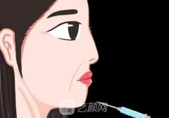 润百颜白紫玻尿酸维持效